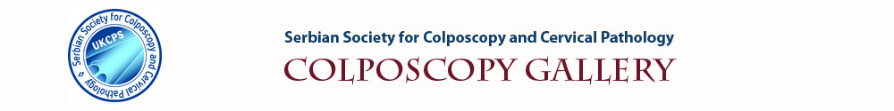 Colposcopy Home